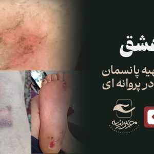 طبیب عشق